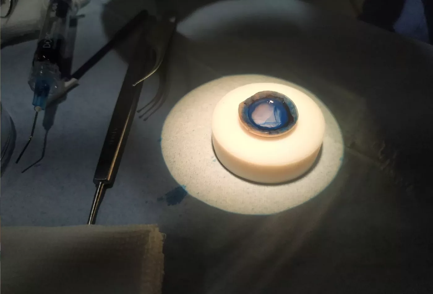 Queratoplastia lamelar endotelial (DMEK)