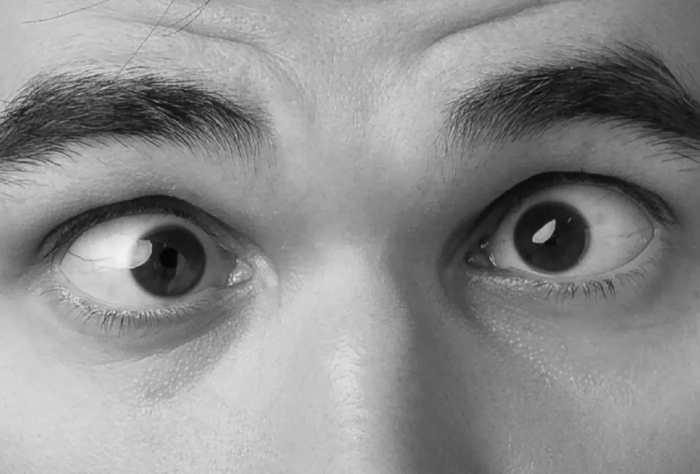 El nistagmo ocular o temblor de los ojos