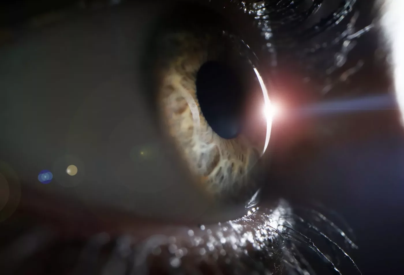 Día Mundial del Glaucoma